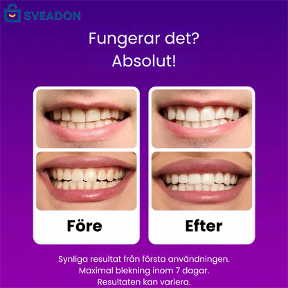 SmileGlow™ – Vita Tänder Som Känns Lika Bra Som De Ser Ut