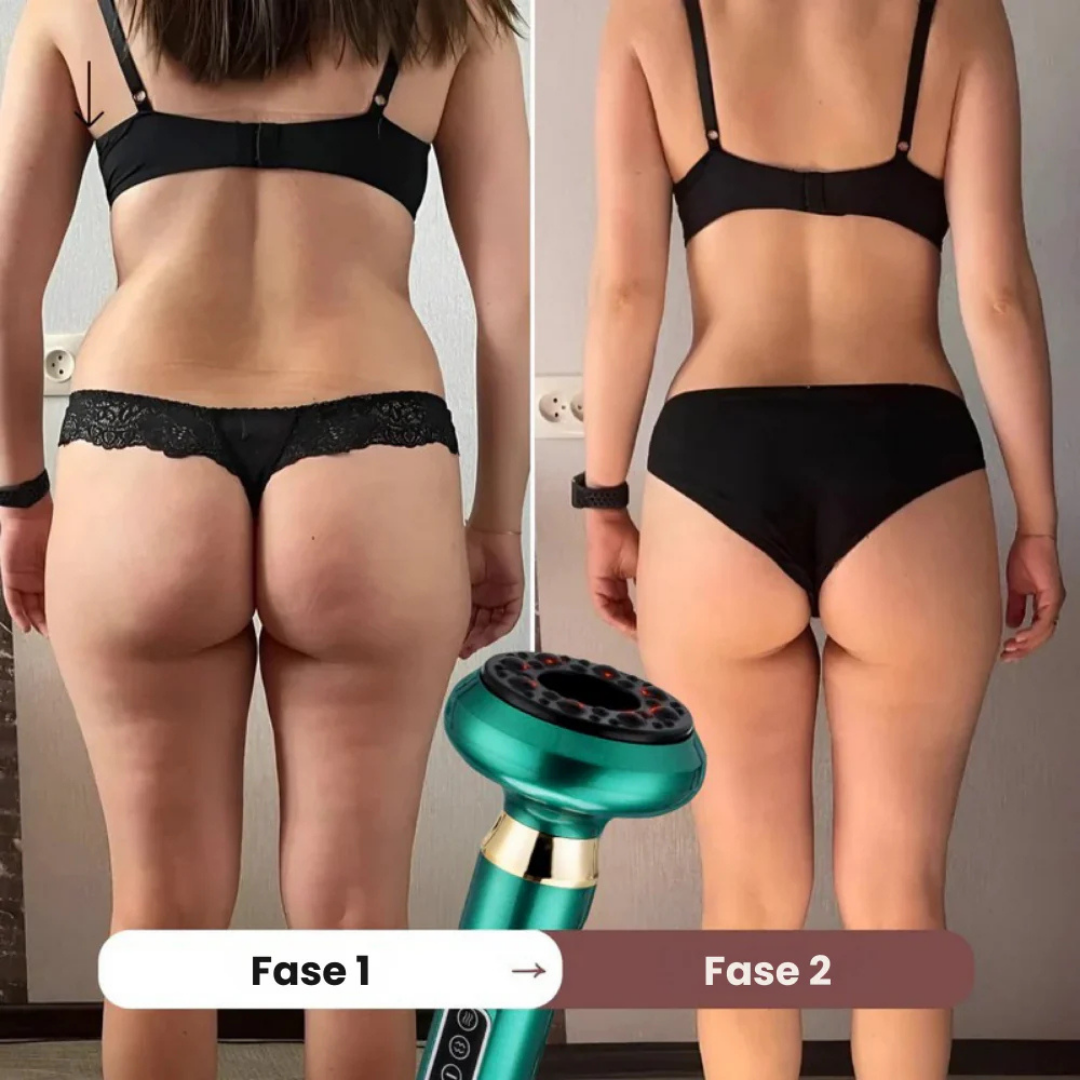 LumiShape™ | Säg adjö till celluliter och hej till din bästa hud någonsin.