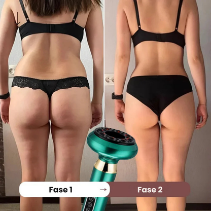 LumiShape™ | Säg adjö till celluliter och hej till din bästa hud någonsin.