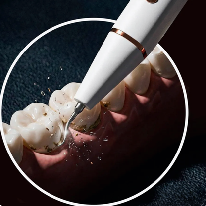 Dentify™ – Ultraljudsrengöring