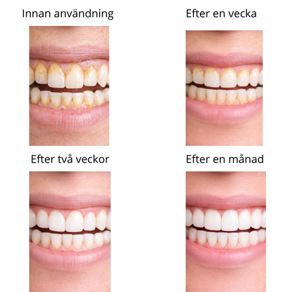 Dentify™ – Ultraljudsrengöring