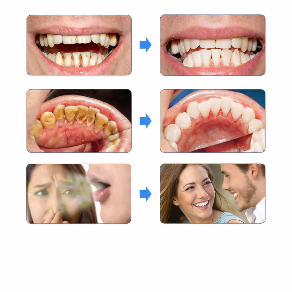 Dentify™ – Ultraljudsrengöring