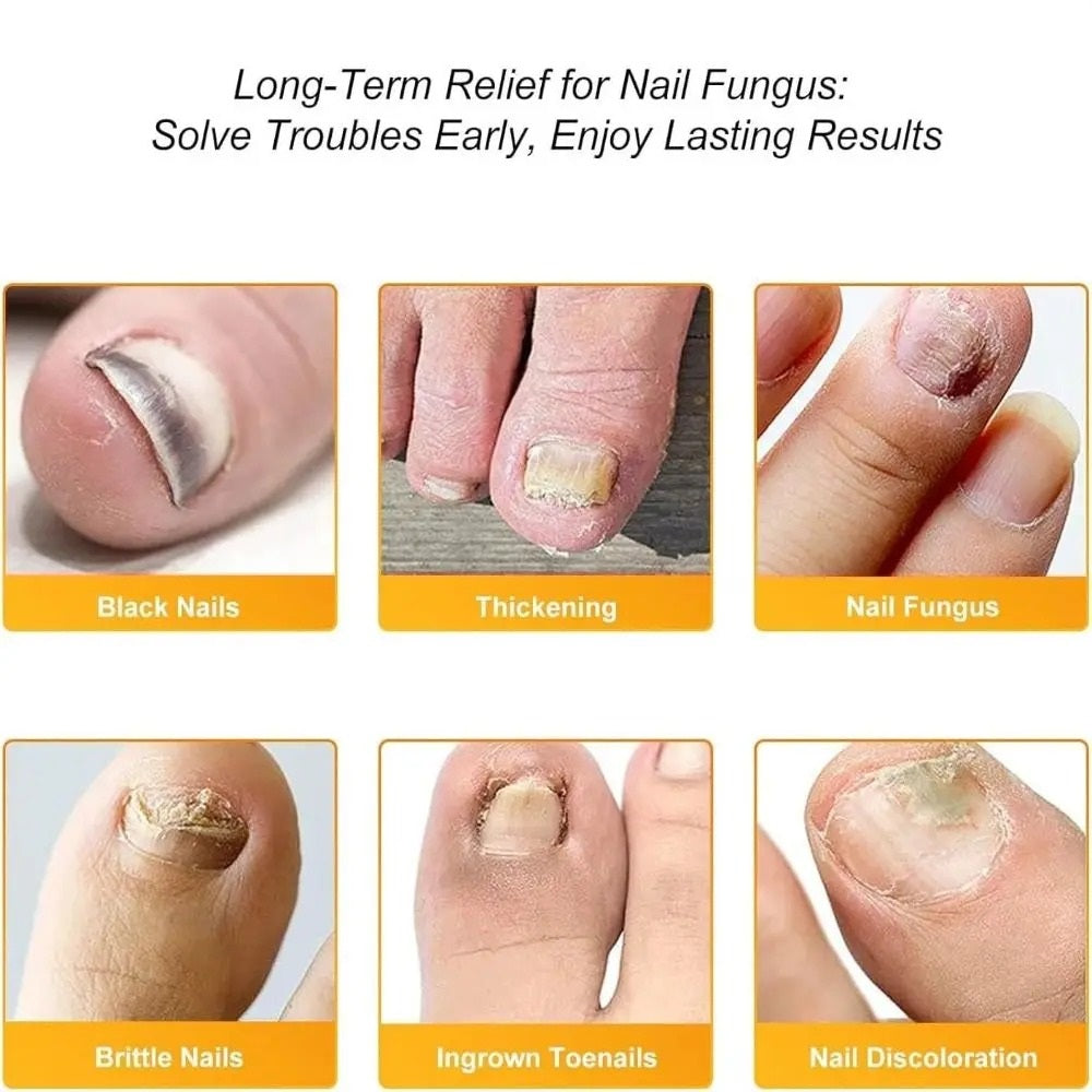 KlarNagel™ - Antibakteriellt och svampdödande plåster samt nagelvårdspaket
