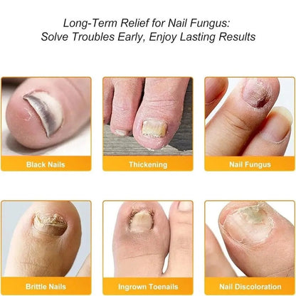 KlarNagel™ - Antibakteriellt och svampdödande plåster samt nagelvårdspaket
