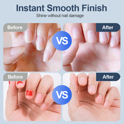 SoftNail™ Automatisk Nagelfil